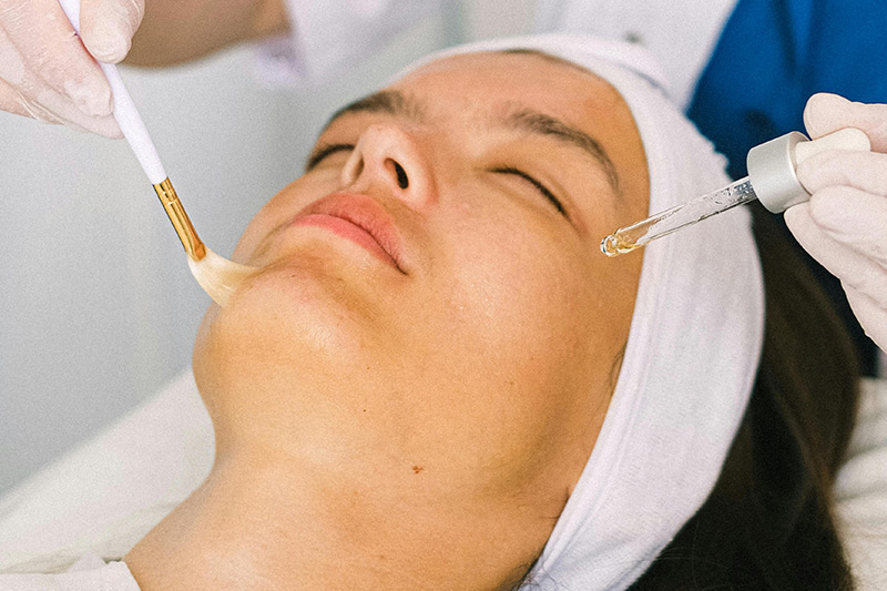 chemical skin peel facial treatment chemical skin peel facial treatment